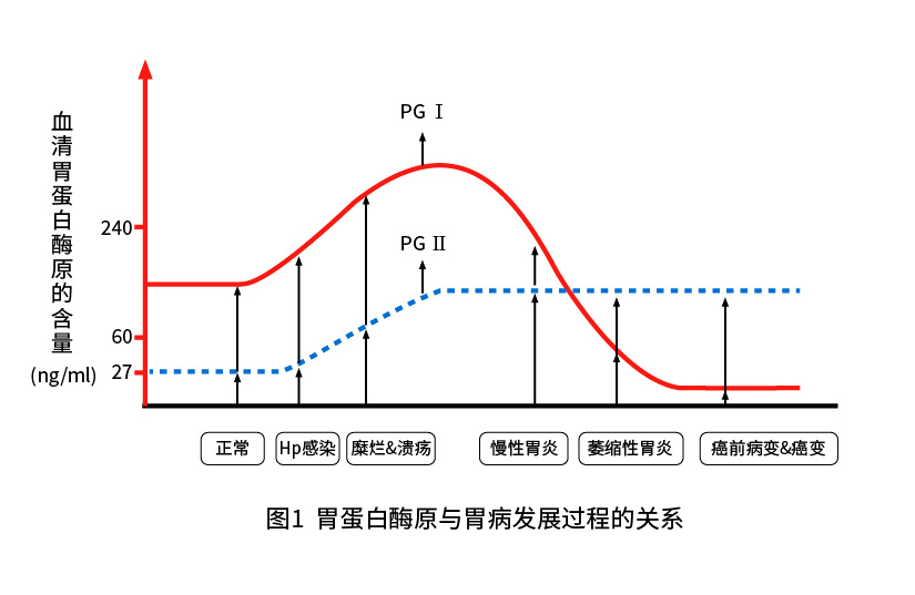 胃蛋白酶原Ⅰ（PGⅠ）和胃蛋白酶原Ⅱ（PGⅡ）與胃部疾病的關系